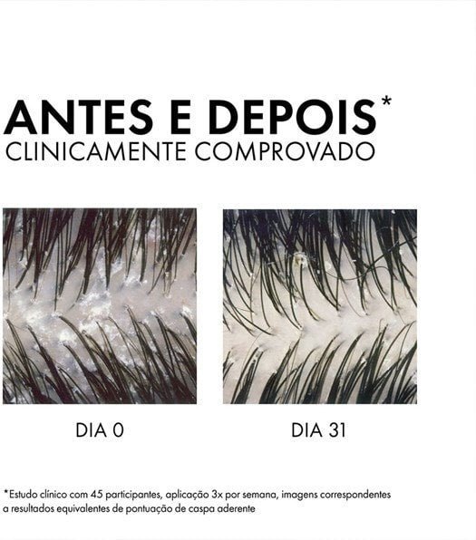 Shampoo Anticaspa Intensivo DS Cabelos Secos 125G - Imagem 8